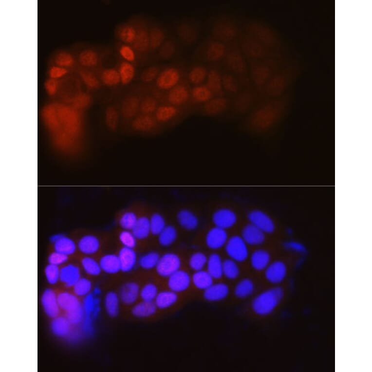 Immunofluorescence - Anti-Estrogen Receptor alpha Antibody [ARC0199] (A93057) - Antibodies.com