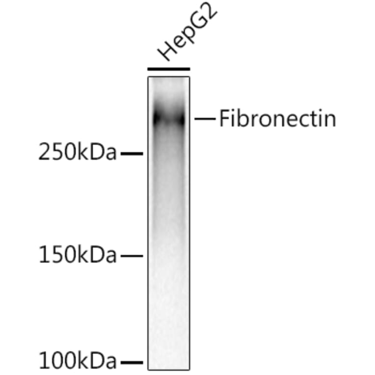 Western Blot - Anti-Fibronectin Antibody [ARC2692] (A93062) - Antibodies.com