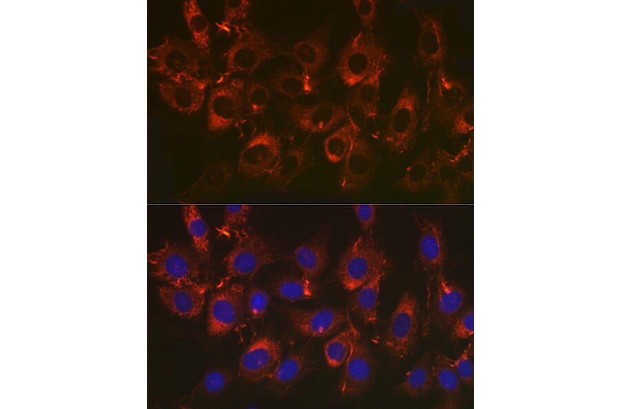 Immunofluorescence - Anti-Fibronectin Antibody [ARC2692] (A93062) - Antibodies.com