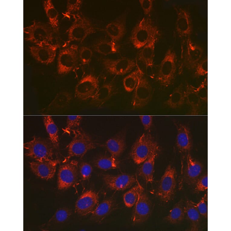 Immunofluorescence - Anti-Fibronectin Antibody [ARC2692] (A93062) - Antibodies.com
