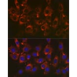 Immunofluorescence - Anti-Fibronectin Antibody [ARC2692] (A93062) - Antibodies.com