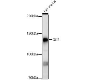Western Blot - Anti-Gli2 Antibody (A93068) - Antibodies.com