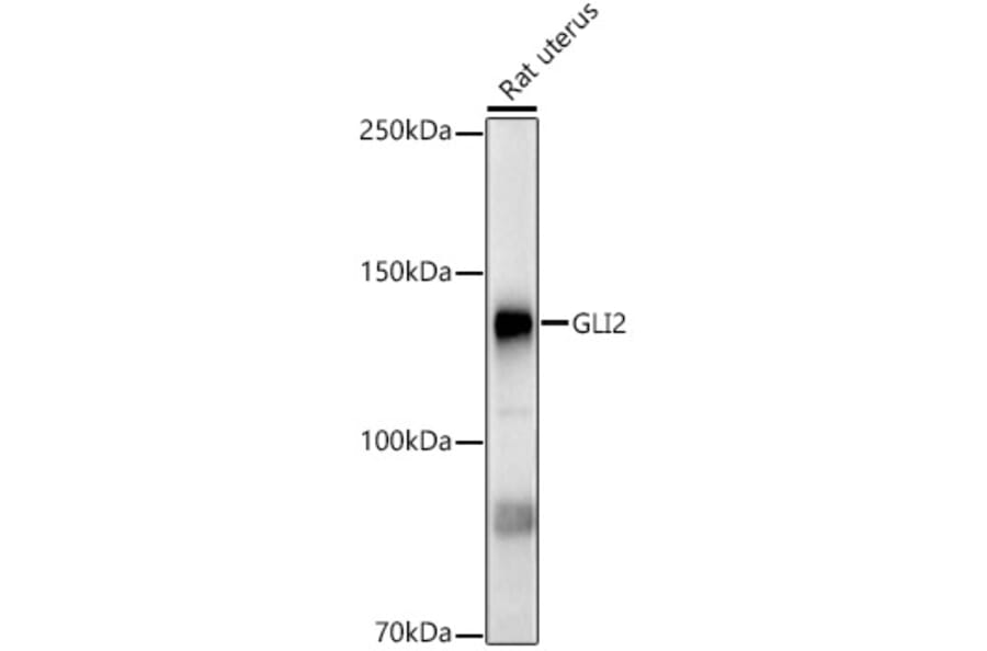 Western Blot - Anti-Gli2 Antibody (A93068) - Antibodies.com