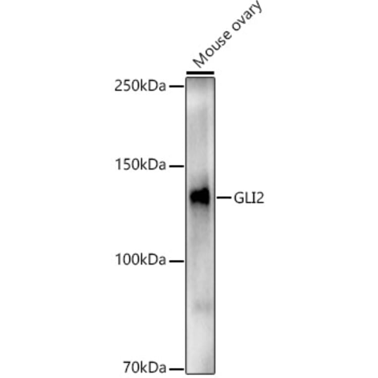 Western Blot - Anti-Gli2 Antibody (A93068) - Antibodies.com
