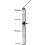 Western Blot - Anti-Gli2 Antibody (A93068) - Antibodies.com