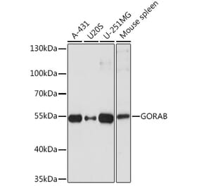 Western Blot - Anti-GORAB Antibody (A93069) - Antibodies.com