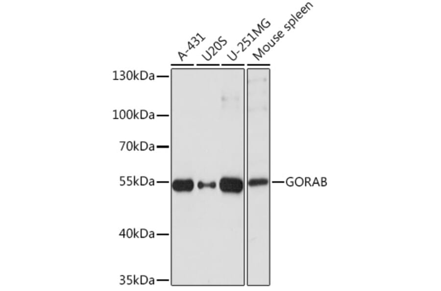Western Blot - Anti-GORAB Antibody (A93069) - Antibodies.com