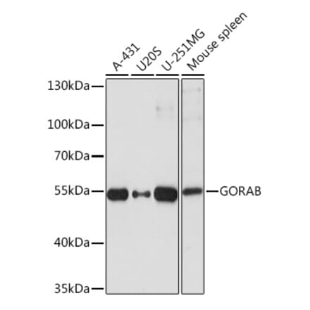 Western Blot - Anti-GORAB Antibody (A93069) - Antibodies.com