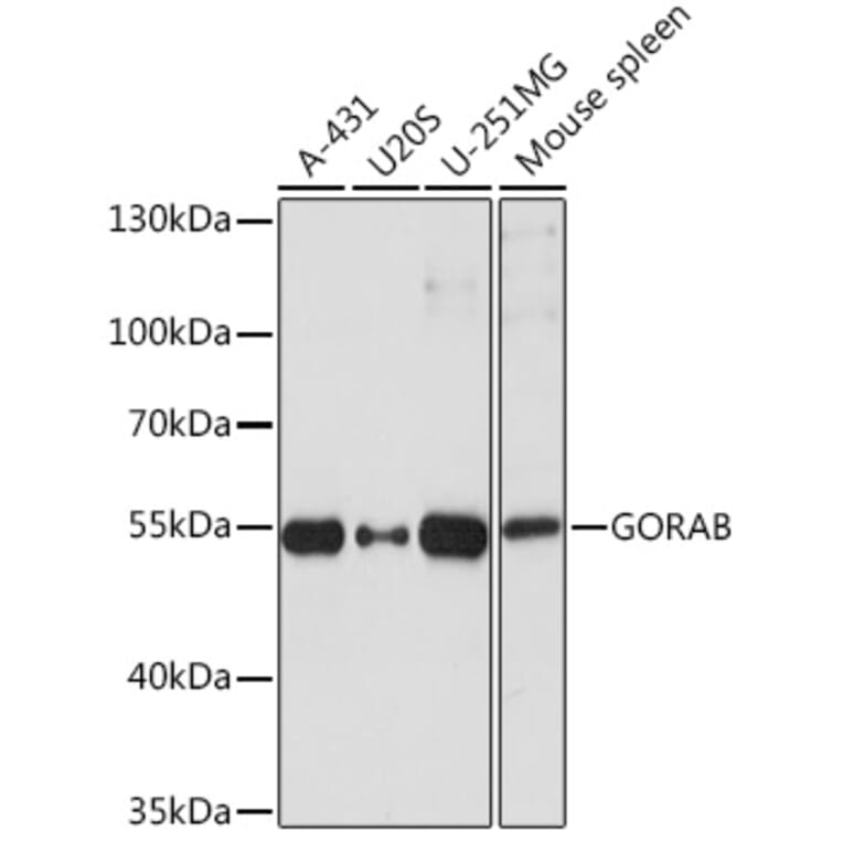 Western Blot - Anti-GORAB Antibody (A93069) - Antibodies.com