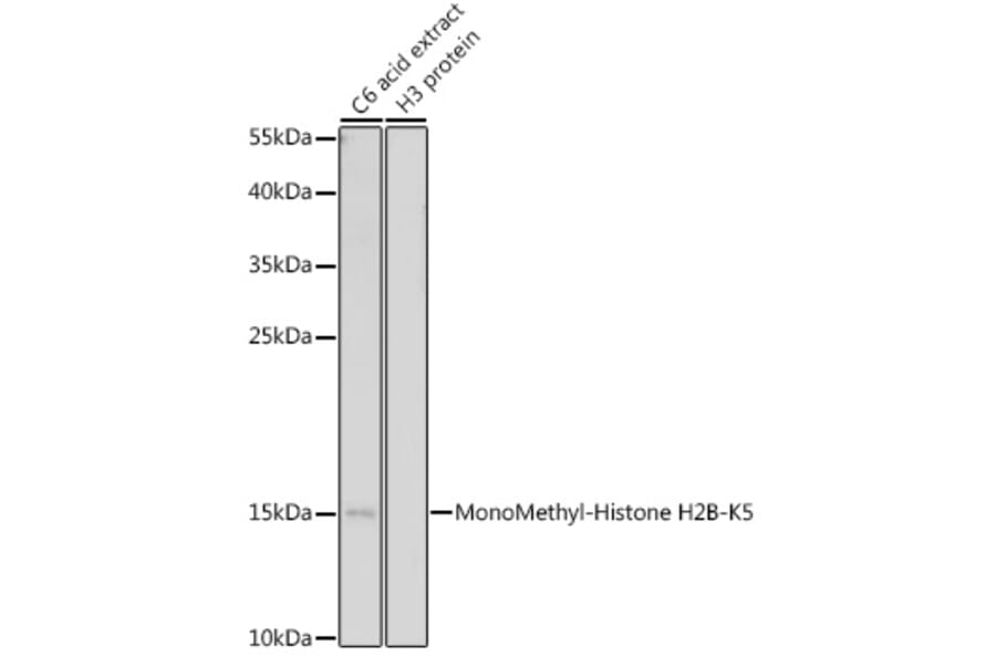 Western Blot - Anti-Histone H2B (mono methyl Lys5) Antibody (A93072) - Antibodies.com