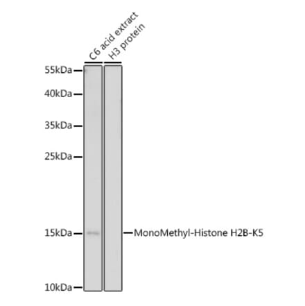 Western Blot - Anti-Histone H2B (mono methyl Lys5) Antibody (A93072) - Antibodies.com