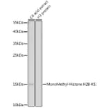 Western Blot - Anti-Histone H2B (mono methyl Lys5) Antibody (A93072) - Antibodies.com