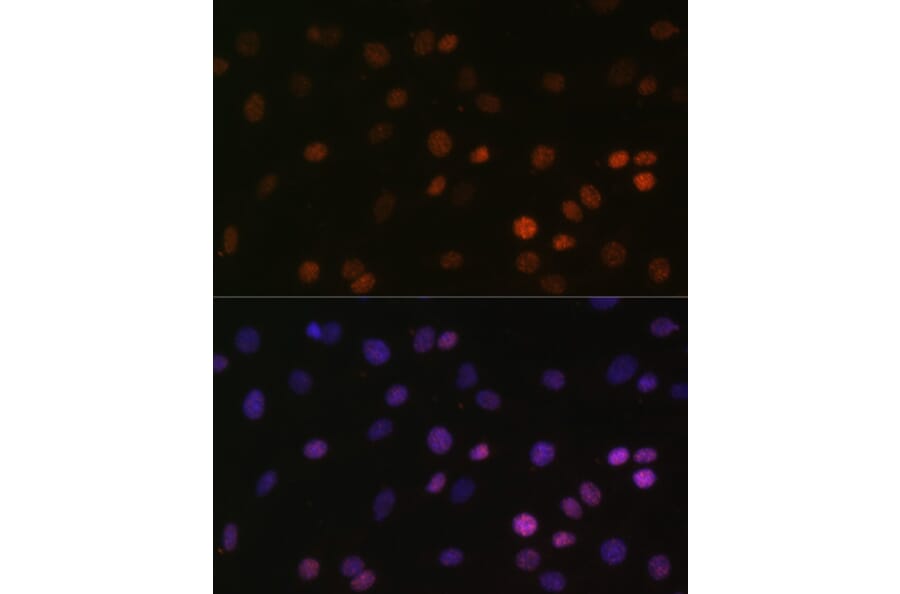 Immunofluorescence - Anti-Histone H2B (mono methyl Lys5) Antibody (A93072) - Antibodies.com