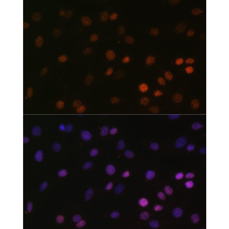 Immunofluorescence - Anti-Histone H2B (mono methyl Lys5) Antibody (A93072) - Antibodies.com