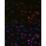 Immunofluorescence - Anti-Histone H2B (mono methyl Lys5) Antibody (A93072) - Antibodies.com