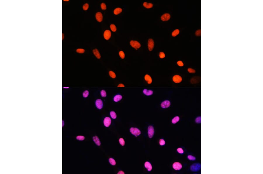 Immunofluorescence - Anti-Histone H2B (mono methyl Lys5) Antibody (A93072) - Antibodies.com