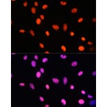Immunofluorescence - Anti-Histone H2B (mono methyl Lys5) Antibody (A93072) - Antibodies.com