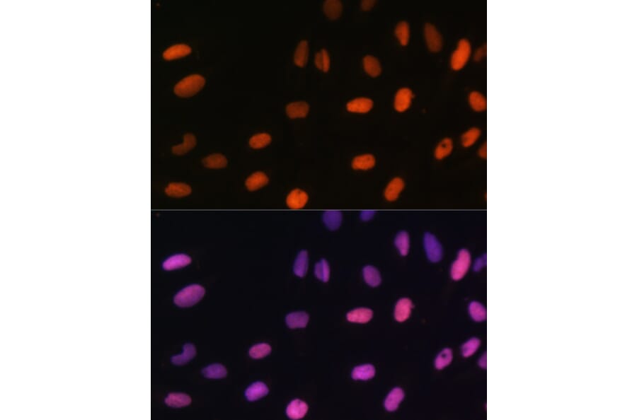 Immunofluorescence - Anti-Histone H2B (mono methyl Lys5) Antibody (A93072) - Antibodies.com