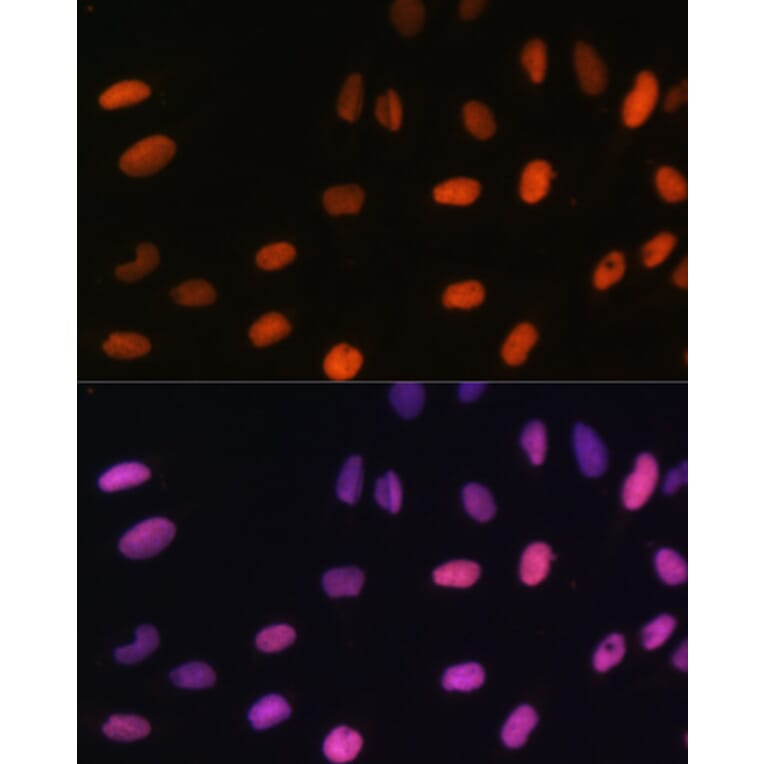 Immunofluorescence - Anti-Histone H2B (mono methyl Lys5) Antibody (A93072) - Antibodies.com