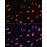 Immunofluorescence - Anti-Histone H2B (mono methyl Lys5) Antibody (A93072) - Antibodies.com