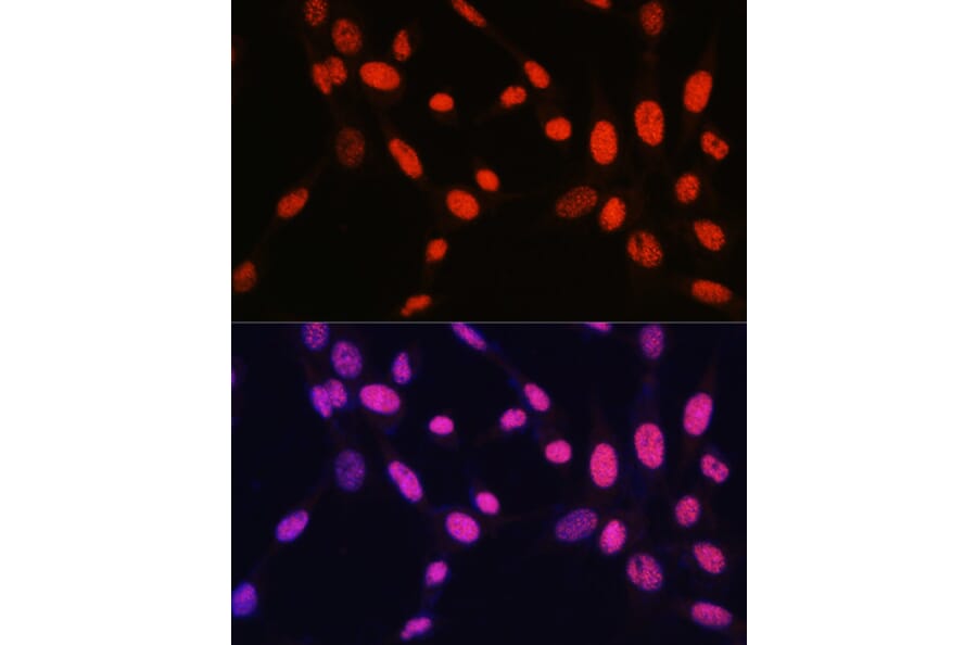 Immunofluorescence - Anti-Histone H2B (mono methyl Lys5) Antibody (A93072) - Antibodies.com