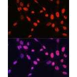 Immunofluorescence - Anti-Histone H2B (mono methyl Lys5) Antibody (A93072) - Antibodies.com
