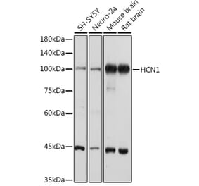 Western Blot - Anti-HCN1 Antibody (A93074) - Antibodies.com