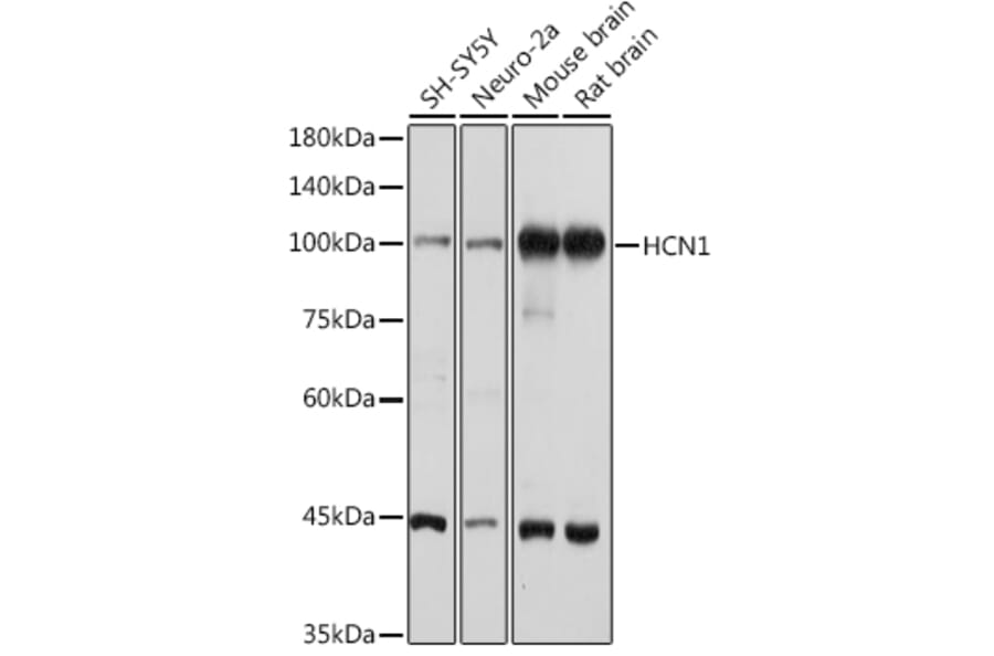 Western Blot - Anti-HCN1 Antibody (A93074) - Antibodies.com