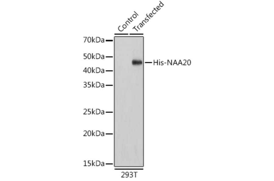 Western Blot - Anti-His Tag Antibody [AMC0484] (HRP) (A93078) - Antibodies.com