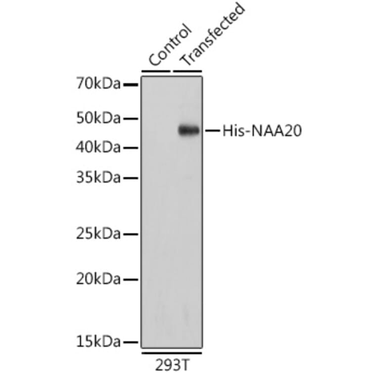 Western Blot - Anti-His Tag Antibody [AMC0484] (HRP) (A93078) - Antibodies.com