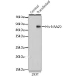 Western Blot - Anti-His Tag Antibody [AMC0484] (HRP) (A93078) - Antibodies.com
