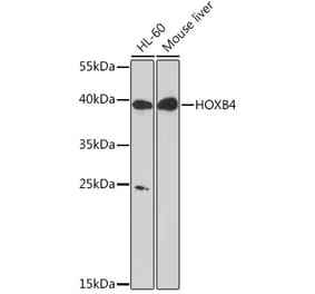 Western Blot - Anti-HOXB4 Antibody (A93080) - Antibodies.com