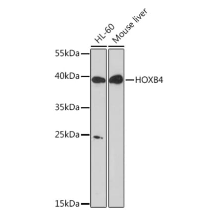 Western Blot - Anti-HOXB4 Antibody (A93080) - Antibodies.com