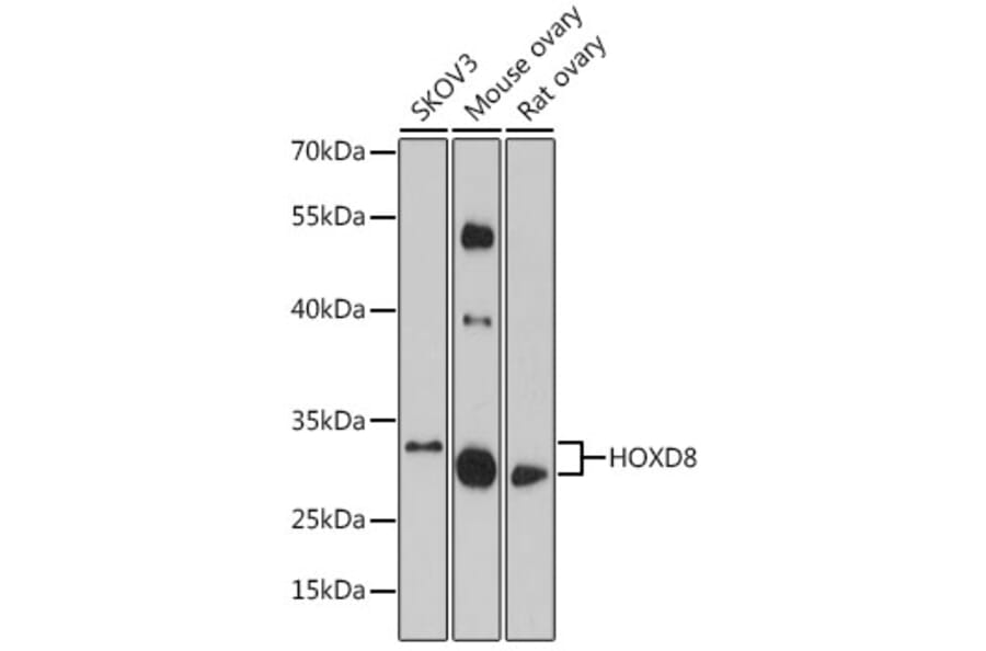 Western Blot - Anti-HOXD8 Antibody (A93081) - Antibodies.com