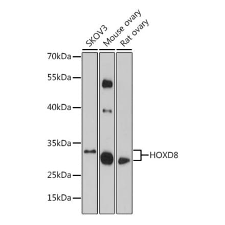 Western Blot - Anti-HOXD8 Antibody (A93081) - Antibodies.com