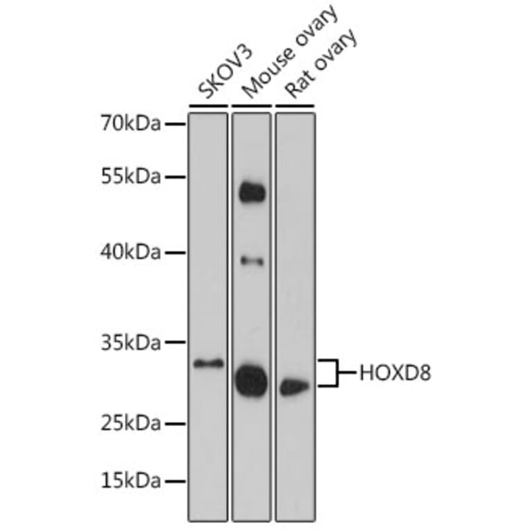 Western Blot - Anti-HOXD8 Antibody (A93081) - Antibodies.com