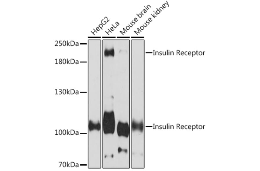 Western Blot - Anti-Insulin Receptor alpha Antibody (A93083) - Antibodies.com