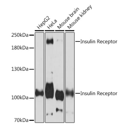 Western Blot - Anti-Insulin Receptor alpha Antibody (A93083) - Antibodies.com