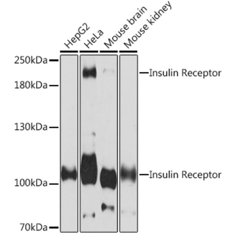 Western Blot - Anti-Insulin Receptor alpha Antibody (A93083) - Antibodies.com