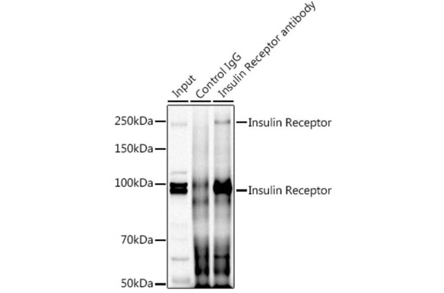 Western Blot - Anti-Insulin Receptor alpha Antibody (A93083) - Antibodies.com