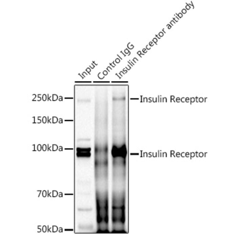 Western Blot - Anti-Insulin Receptor alpha Antibody (A93083) - Antibodies.com