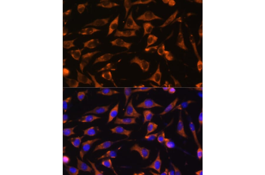 Immunofluorescence - Anti-KANK1 Antibody (A93088) - Antibodies.com