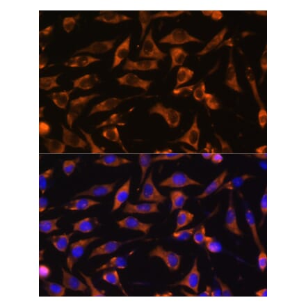 Immunofluorescence - Anti-KANK1 Antibody (A93088) - Antibodies.com