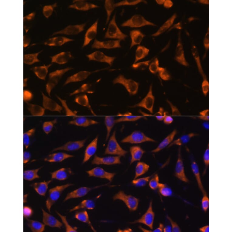 Immunofluorescence - Anti-KANK1 Antibody (A93088) - Antibodies.com