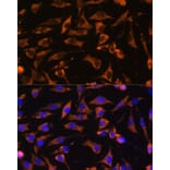 Immunofluorescence - Anti-KANK1 Antibody (A93088) - Antibodies.com