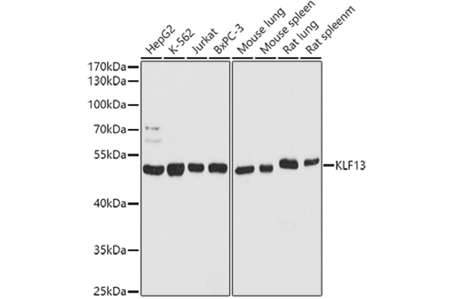 Western Blot - Anti-KLF13 Antibody (A93089) - Antibodies.com