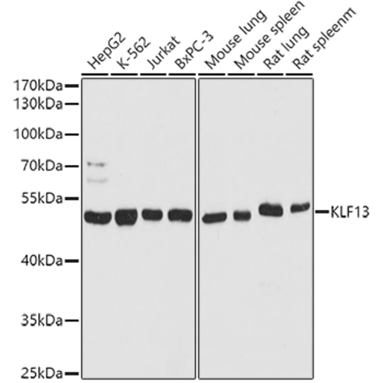 Western Blot - Anti-KLF13 Antibody (A93089) - Antibodies.com