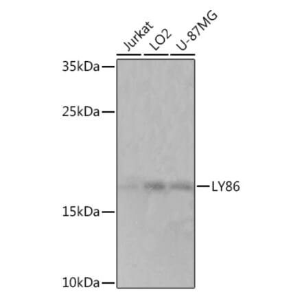 Western Blot - Anti-MD1 Antibody (A93091) - Antibodies.com