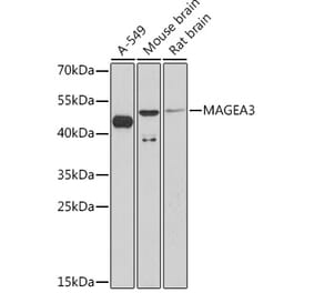 Western Blot - Anti-MAGE3 Antibody (A93092) - Antibodies.com