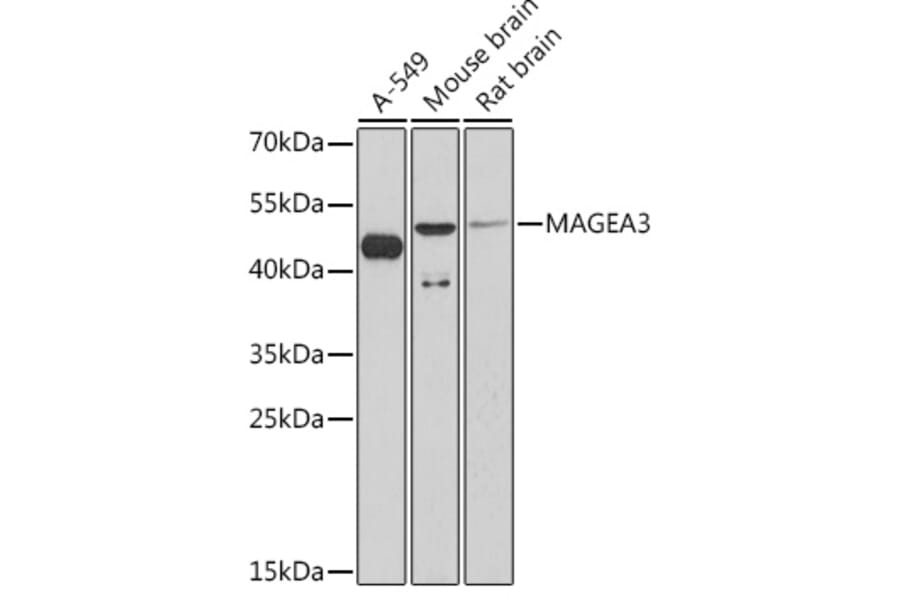 Western Blot - Anti-MAGE3 Antibody (A93092) - Antibodies.com